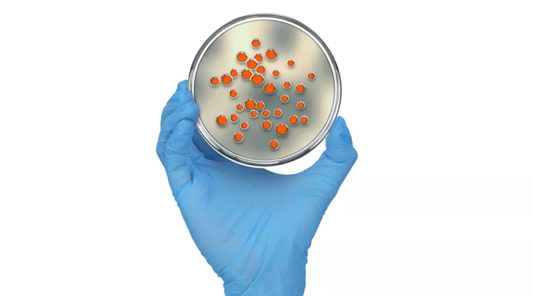 CFUs on petri dish